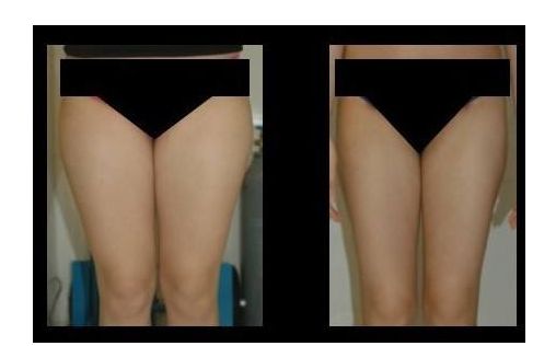 成都西區(qū)醫(yī)院整形科——專家細(xì)細(xì)解讀與價(jià)目表展示