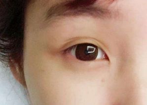 2023寧波隆鼻醫(yī)生排行榜：張廣巍、任森洋、肖慶華五位備受矚目的醫(yī)師解析及收費(fèi)信息！