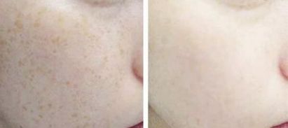 2023昆明下頜角整形臉部護理達人該怎么樣選擇？陳曦、錢靜、楊保祥等讓您信賴！