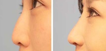 哈爾濱頂級美容整形醫(yī)院前七評選結(jié)果揭曉，驚喜連連！公立醫(yī)院也進(jìn)榜，讓你驚嘆不已！