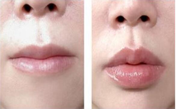 北京柏麗整形醫(yī)院的整形效果如何？有哪些專家醫(yī)生可以選擇？