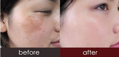 西安最佳雙眼皮手術(shù)醫(yī)院推薦，網(wǎng)友口碑評價！