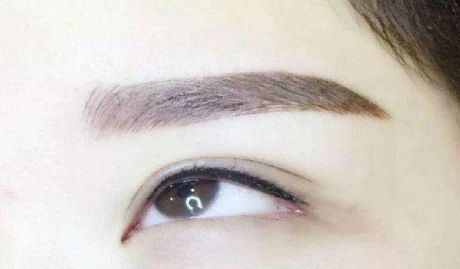 咨詢陳曉勇醫(yī)生雙眼皮手術(shù)效果如何？親身經(jīng)歷分享一覽