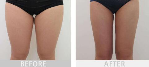 2023年德化縣醫(yī)院整形外科價(jià)目表是否已經(jīng)公布？鄭向陽的口碑和經(jīng)驗(yàn)如何進(jìn)行深度評(píng)點(diǎn)？案例欣賞？