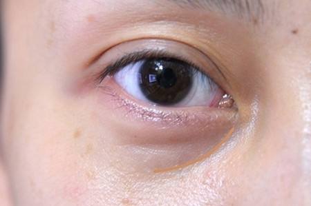 深圳北大醫(yī)院美容皮膚科的詳細(xì)資料是什么？如何了解更多有關(guān)深圳北大醫(yī)院美容皮膚科的信息？