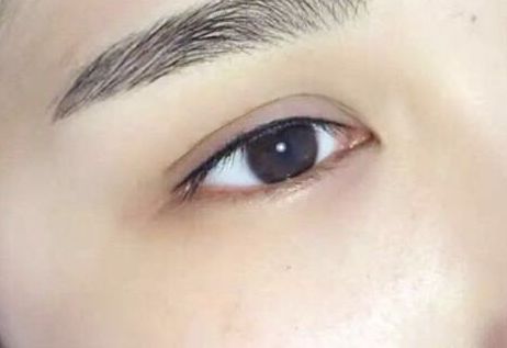 重慶精致拉皮手術(shù)醫(yī)院推薦，前三翹楚，實力不凡！