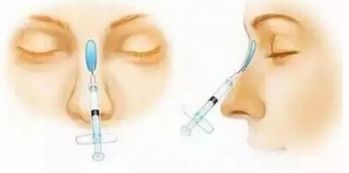 上海五位備受矚目的雙眼皮修復(fù)專家，讓你放心選擇