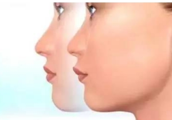 鹽城哪個醫(yī)院的光纖激光治療疤痕效果好？2023年鹽城光纖激光治療疤痕醫(yī)院排名榜TOP10！