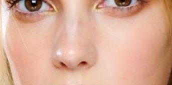 甘肅腫瘤醫(yī)院的口腔科病例圖及矯正價(jià)格一覽