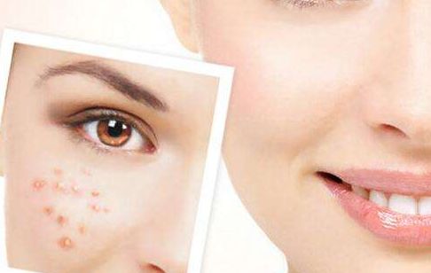 羅瀾濤醫(yī)生的鼻部整形效果如何？醫(yī)師簡(jiǎn)介與花式鼻子案例分享，價(jià)格目錄供參考