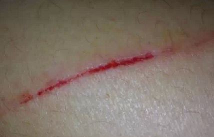 北京聯(lián)合麗格首席醫(yī)生陣容，精選4位超贊吸脂醫(yī)師