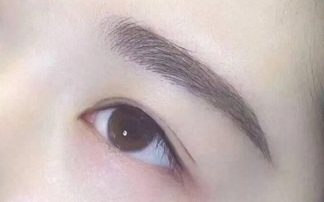 成都蔡震做聽力整形手術的效果與收費情況揭秘