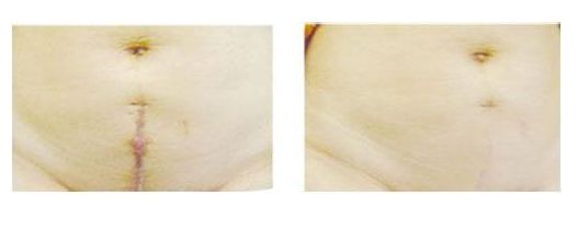 五年內(nèi)天津有口皆碑的隆鼻醫(yī)生排行榜出爐