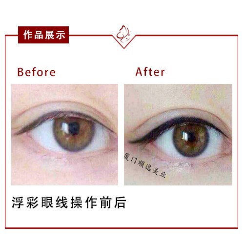 華美整形醫(yī)院在廣州口碑如何？高順福、袁耀東醫(yī)生值得信賴嗎？