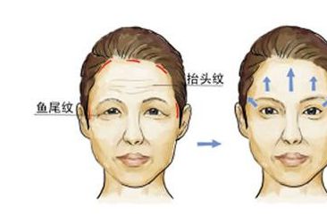 西京整形醫(yī)院：雙眼皮手術(shù)憑什么贏得專家認(rèn)可？親身經(jīng)歷分享