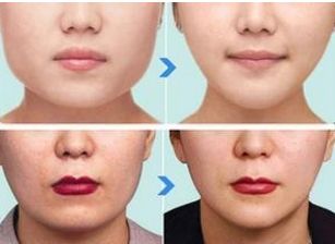 上海排名前十的公立美容醫(yī)院揭秘！技術(shù)、實(shí)力堪比私立！