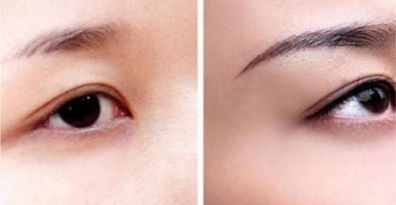 重慶頂尖眼部整形醫(yī)生、醫(yī)院排行榜一覽