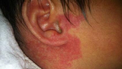 空軍總醫(yī)院整形科怎么樣？從隆鼻醫(yī)生到科普分享，真的那么靠譜嗎？