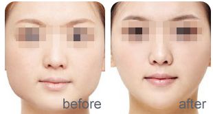 濟(jì)南頂級(jí)醫(yī)美整形機(jī)構(gòu)排行榜！口碑爆棚，超高人氣！