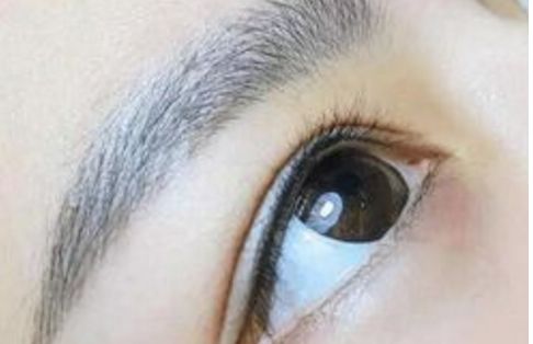 廣州名麗醫(yī)療美容醫(yī)院隆鼻案例分享：真實(shí)口碑大揭秘！