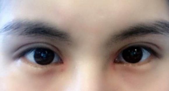 四川華西整形美容科醫(yī)生排行榜前五名，你不能錯(cuò)過的權(quán)威專家！