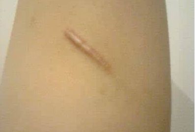 重慶最佳專業(yè)雙眼皮手術(shù)，醫(yī)生名單與真實案例圖震撼揭秘