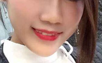 黃印資技術(shù)的鼻子風(fēng)格與個人資料+隆鼻案例