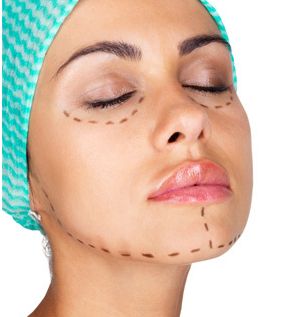 最新資訊！沈干專業(yè)雙眼皮技術(shù)揭秘，真實(shí)案例解析！