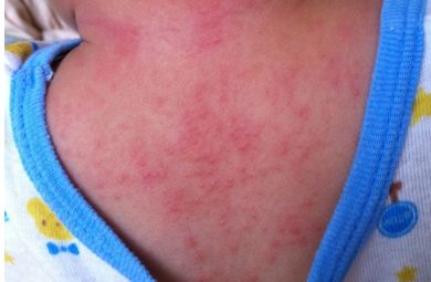 大家對(duì)重慶當(dāng)代整形醫(yī)院醫(yī)生謝錦清的技術(shù)有何評(píng)價(jià)？附有最新隆鼻案例和醫(yī)療解析