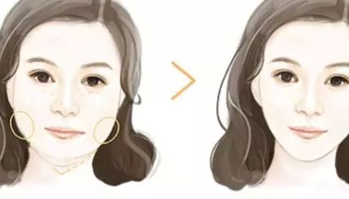 北京哪家整形醫(yī)院的隆鼻效果好？排行榜公開！