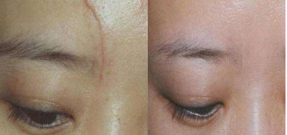 上海九院專業(yè)脂肪填充醫(yī)生排行榜前五名揭曉，想了解的速來！