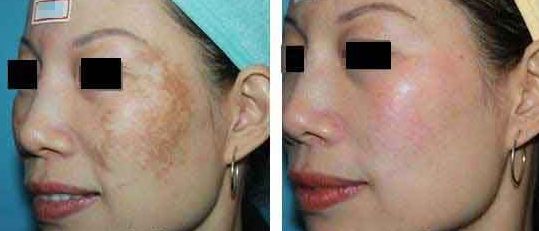 樂山整容醫(yī)院哪家效果好？專業(yè)對(duì)比與推薦！