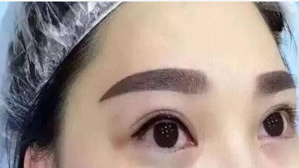 深圳港龍醫(yī)院的醫(yī)生口碑如何？醫(yī)生的技術(shù)水平如何評(píng)價(jià)？