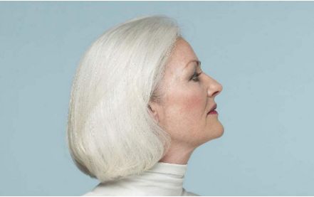 鄭州華領(lǐng)整形醫(yī)院豐胸效果一覽，2023瘦身成功故事詳解