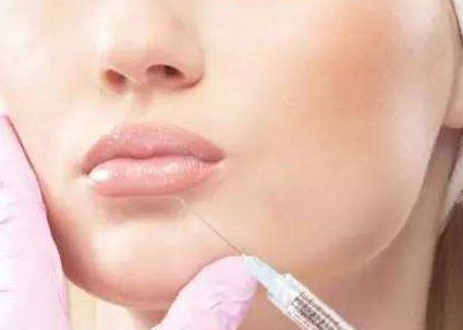 徐占鋒雙眼皮術(shù)后效果如何？專業(yè)醫(yī)生簡介及真實案例分享