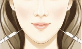 重慶醫(yī)科大學(xué)附屬第一醫(yī)院小蠻腰：雙眼皮手術(shù)無痛、自然、效果好