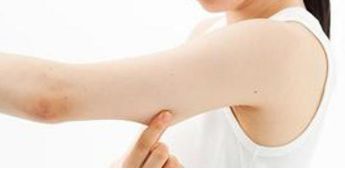 北京醫(yī)院點(diǎn)陣激光技術(shù)排行榜：京城皮膚醫(yī)院、尚美匯豐位列前茅！