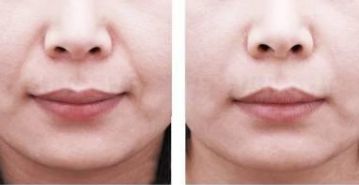 2023年南京熱門提升年輕外貌的知名醫(yī)師排行榜，更新當(dāng)?shù)貍涫苜澴u的專家醫(yī)生推薦詳細(xì)信息一覽