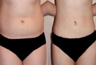 杭州哪家醫(yī)院是顴骨內(nèi)推領(lǐng)域的知名品牌？頂級醫(yī)院排行榜：浙江第一，浙江第二等梳理為參考