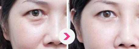 濟(jì)南藝星整形美容醫(yī)院醫(yī)生技術(shù)靠譜嗎？該醫(yī)院的整形效果如何？