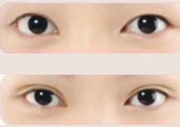 上海星璨整形醫(yī)院，專業(yè)提供驚艷隆鼻技術(shù)，擁有豐富的案例分享