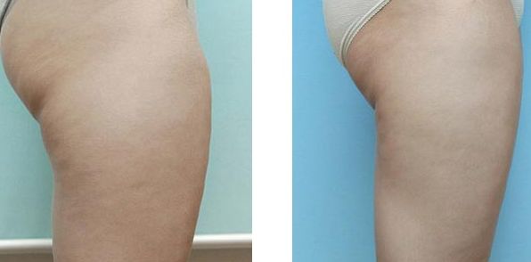 北京優(yōu)質(zhì)整形醫(yī)院鼻子整形排行曝光，醫(yī)療實力揭秘！