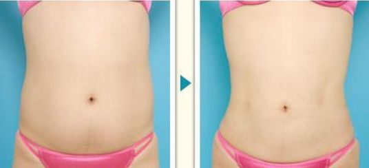 北京最受歡迎的美容院排名前三，熱門醫(yī)院名單不容錯(cuò)過！