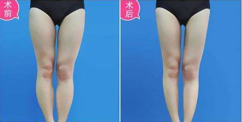 【蘇州】哪家醫(yī)院祛斑人氣高？綜合評(píng)價(jià)稱康美、維多利亞贊譽(yù)最佳！