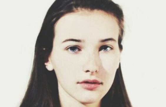 上海九院名醫(yī)許志成幫您輕松解決眼袋問題，真實案例告訴您效果如何！