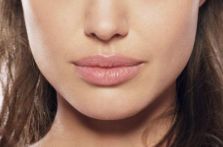 林俊湧醫(yī)師的吸脂手術技術及成功案例回顧