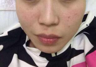 北京藝美醫(yī)療美容診所口碑怎么樣？有哪些值得推薦的醫(yī)生呢？