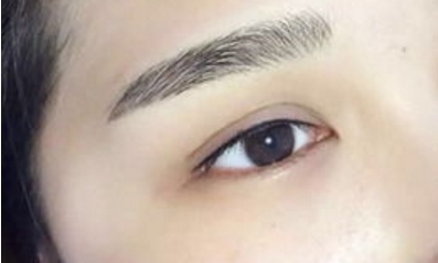 南京施爾美醫(yī)院吸脂效果好不好？南京施爾美醫(yī)院吸脂手術(shù)靠譜嗎？