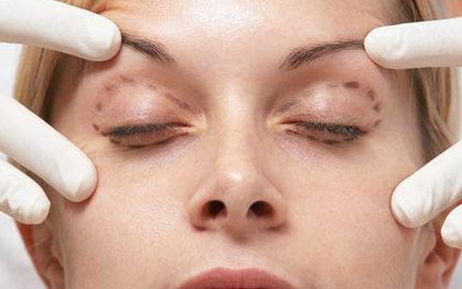 名醫(yī)徐增亮帶你解讀瑞芙臣祛痘技術(shù)，真實(shí)案例和價(jià)格信息全揭秘！