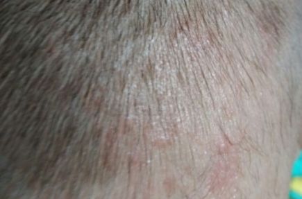 銀川奧蕊斯整形醫(yī)院震驚！驚艷面容煥然一新案例披露